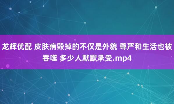 龙辉优配 皮肤病毁掉的不仅是外貌 尊严和生活也被吞噬 多少人默默承受.mp4